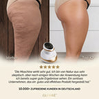GLOVRÉ™ – Cellulite-Behandlung