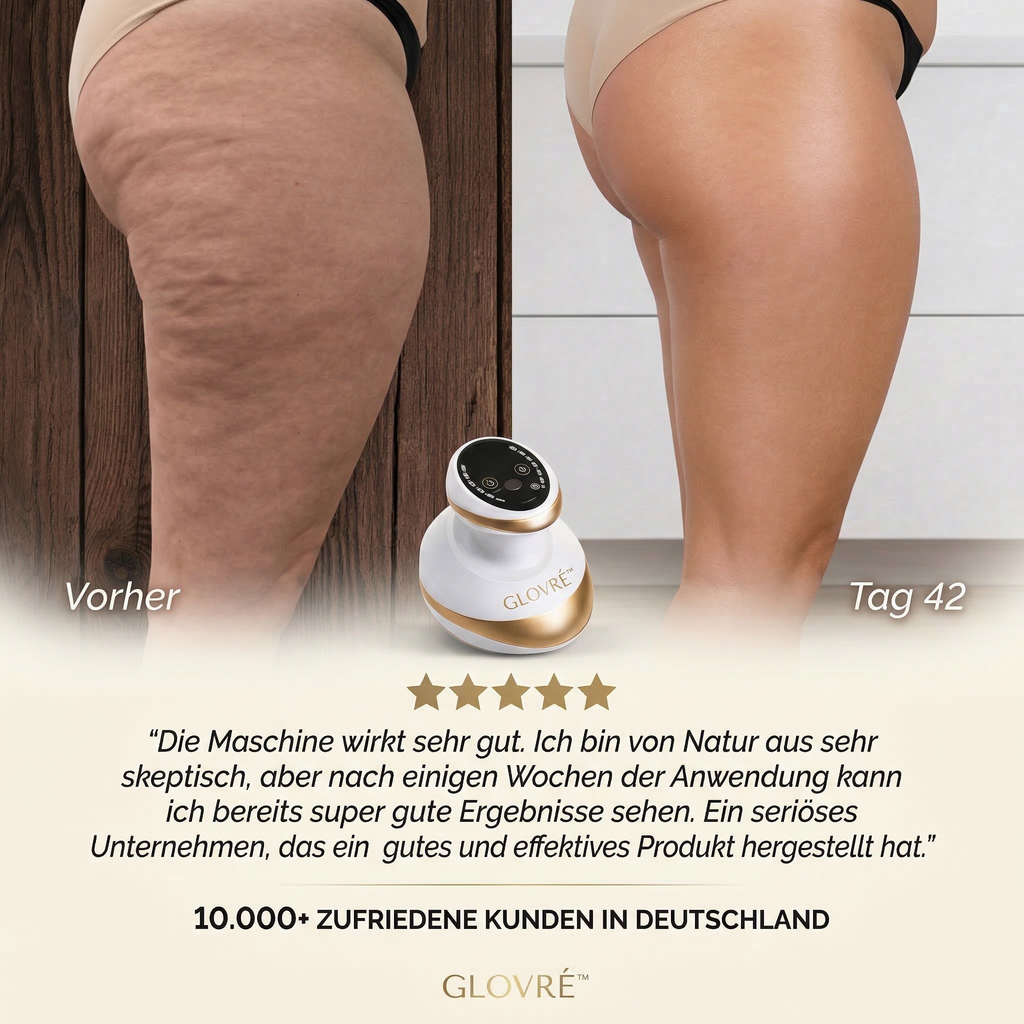 GLOVRÉ™ – Cellulite-Behandlung